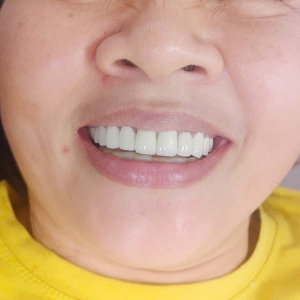 nha-khoa-hoa-le-dia-chi-lam-rang-uy-tin-tai-tan-uyen-binh-duong